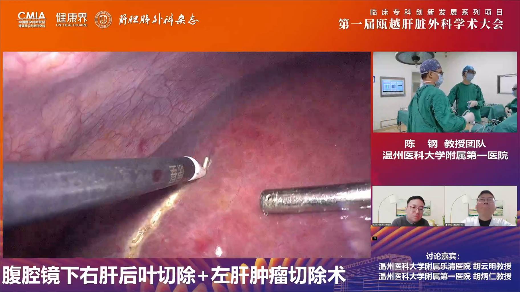 陈钢团队手术直播.jpg